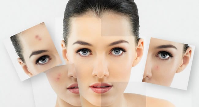 Esteticista Malaga
