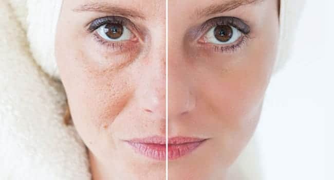 limpieza-de-cutis-beneficios.jpg limpieza de cutis beneficios