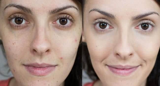 limpieza-facial-opiniones.jpg limpieza facial opiniones