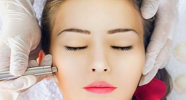 microdermoabrasion-cuantas-sesiones.jpg microdermoabrasion cuantas sesiones