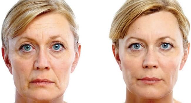 radiofrecuencia-facial-malaga.jpg radiofrecuencia facial malaga
