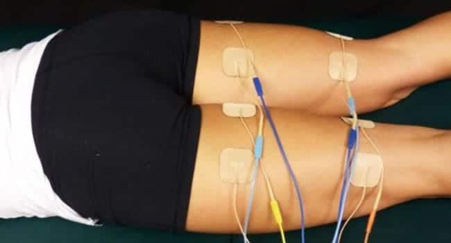 electroestimulacion flacidez